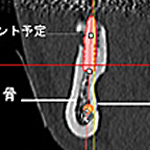 CT画像2