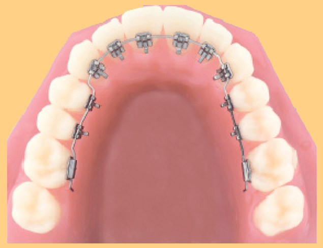 modal image